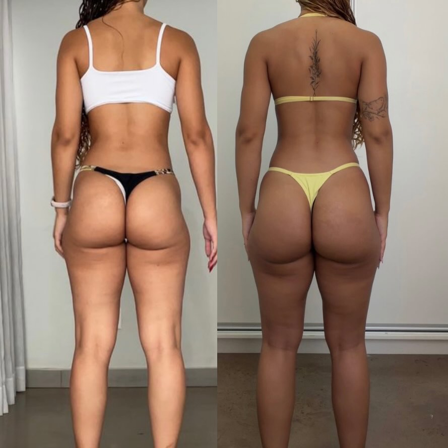 Clara Rocha — antes e depois da transformação do glúteo